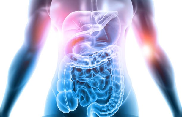 diet-for-healthy-gut